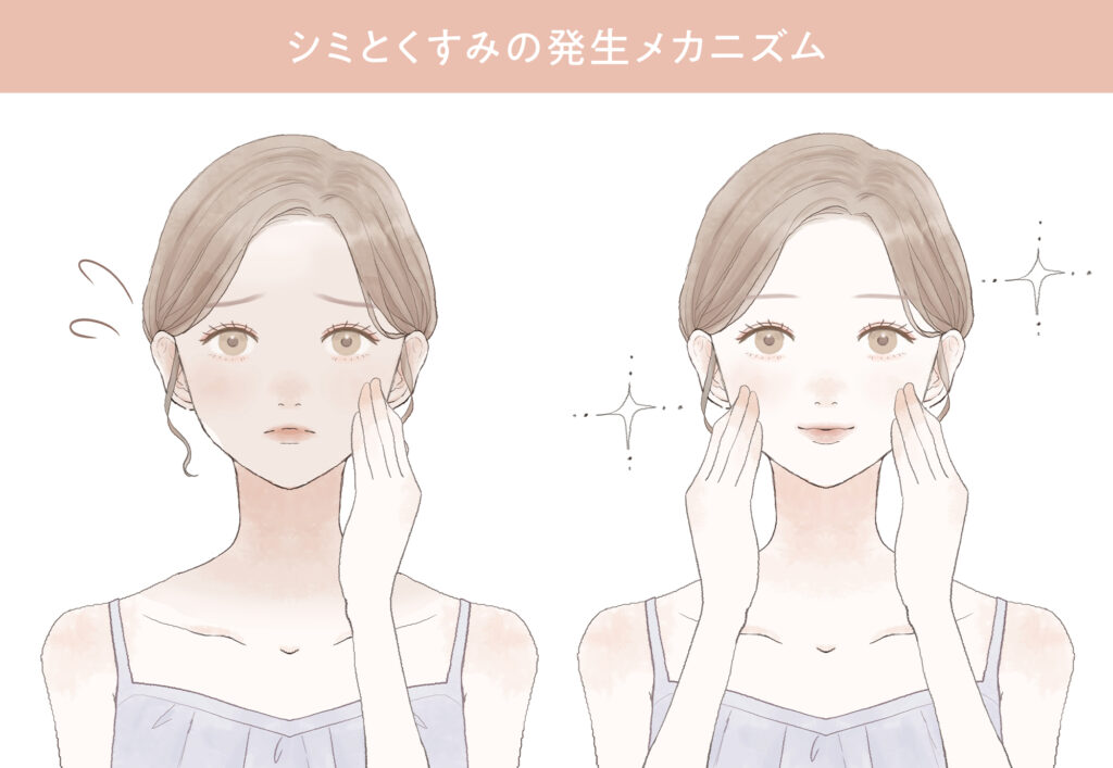 理由の分解：シミとくすみの発生メカニズム