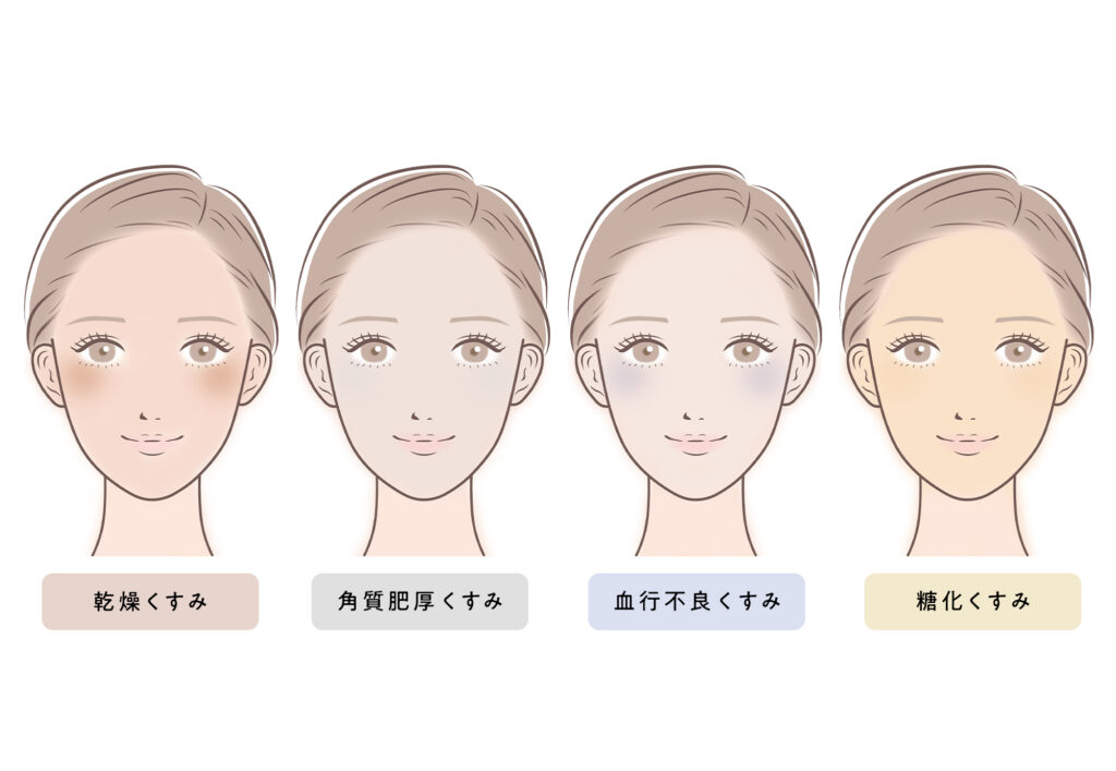くすみの4分類とそれぞれの原因・対策